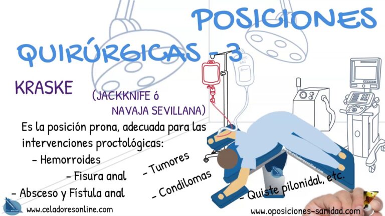 La Posición Anatómica de la Navaja Sevillana